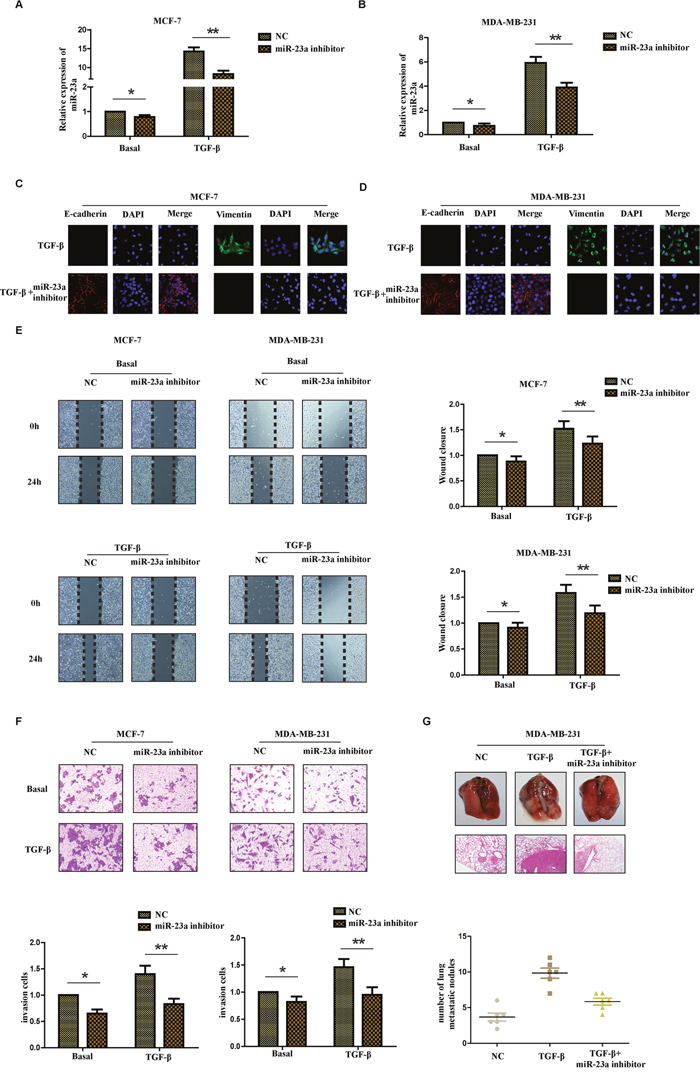 Inhibition of miR-23a suppresses the TGF-&#x03B2;1-induced EMT, the migration and invasion ability of breast cancer cells treated with TGF-&#x03B2;1.