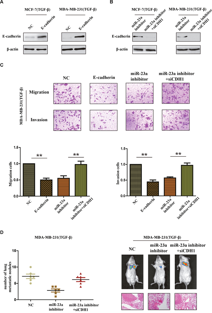 CDH1 critically contributes to the pro-metastatic function of miR-23a in breast cancer cells with TGF-&#x03B2;1 treatment.