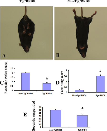 Abnormal motor function phenotypes in TgCRND8 mice at the age of 3 months.