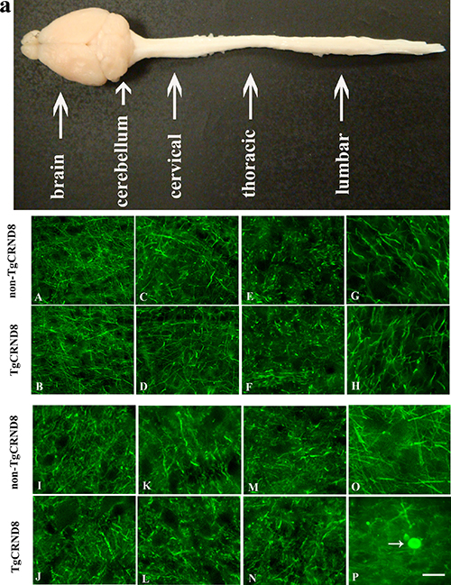 NF200 immunohistochemical staining indicated no axonopathy in the brain and spinal cord of TgCRND8 mice at the age of 3 months compared to age-matched non-TgCRND8 mice.
