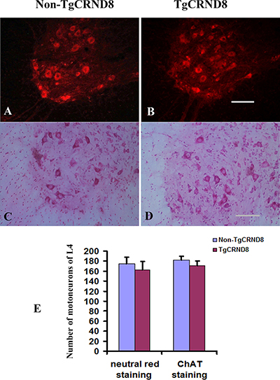 Absence of motoneuron loss in the lumbar cord of TgCRND8 mice at the age of 3 months.