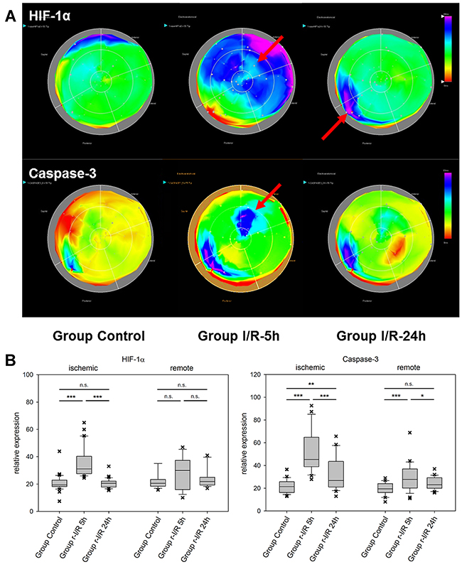 Spatiotemporal 2D bulls-eye display of HIF-1&#x03B1;, and caspase-3 gene expression of the entire left ventricle after repetitive ischemia/reperfusion (r-I/R).