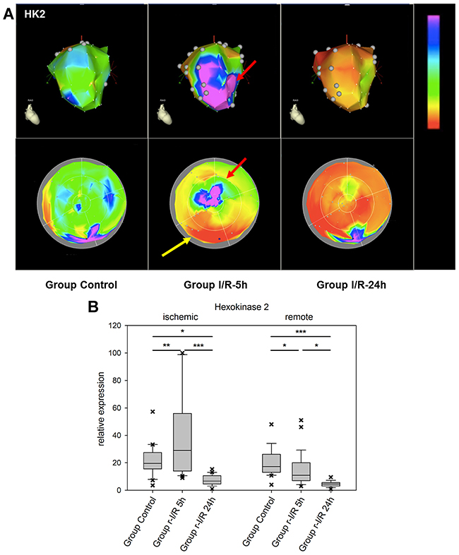 Image-omics (2D and 3D modeling) of the repetitive ischemia/reperfusion (I/R) induced gene expression pattern of hexokinase 2 (HK2).