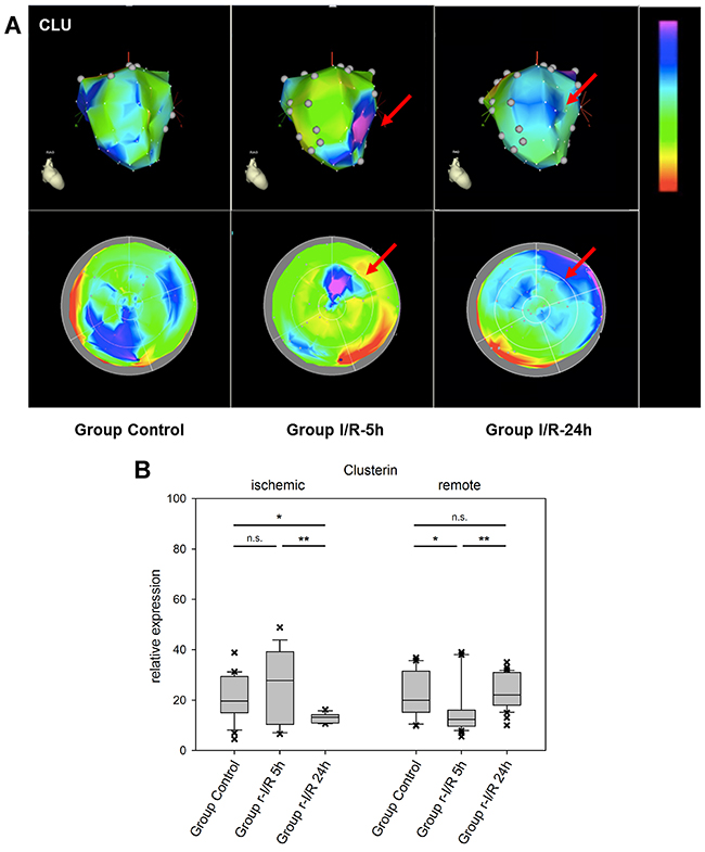 Image-omics (2D and 3D modeling) of the repetitive ischemia/reperfusion (I/R) induced gene expression pattern of clusterin (CLU).