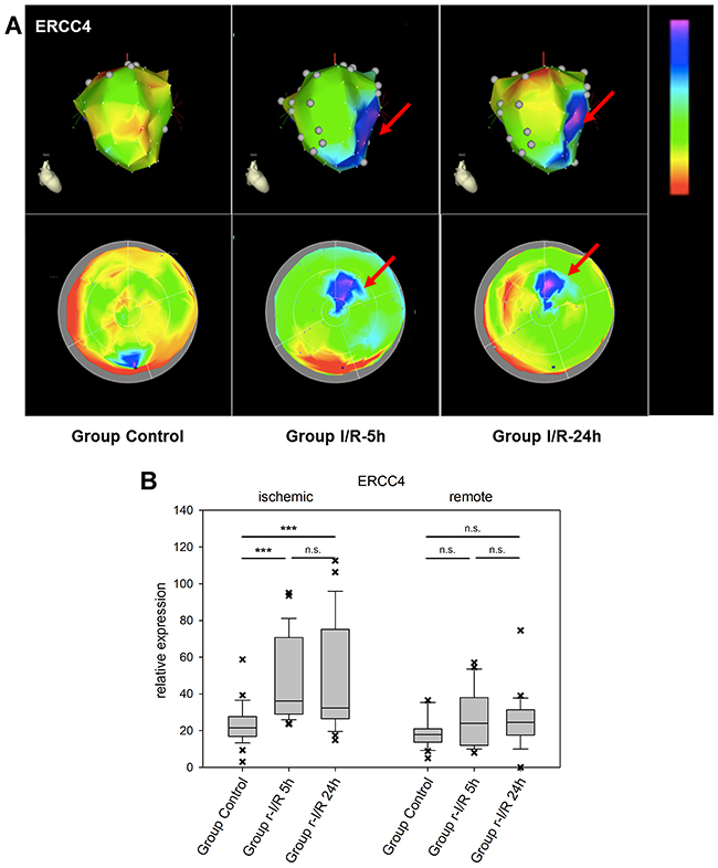 Image-omics (2D and 3D modeling) of the repetitive ischemia/reperfusion (I/R) induced gene expression pattern of excision repair cross-complementation group 4 (ERCC4).