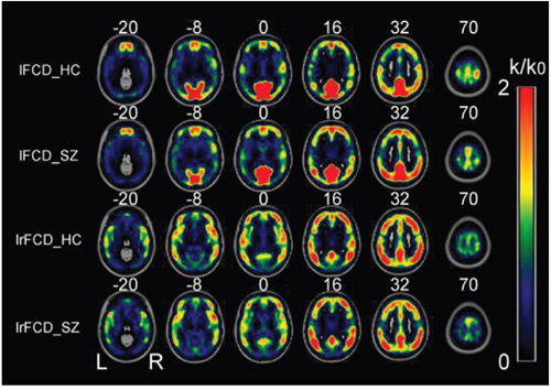 Spatial distributions of the average rescaled lFCD and lrFCD hubs in healthy control individuals and schizophrenia patients.