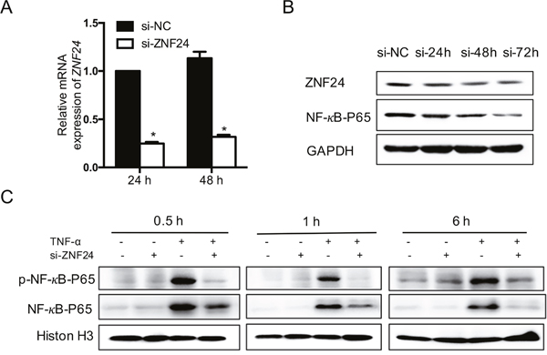 Effect of ZNF24 on NF-&kappa;B.