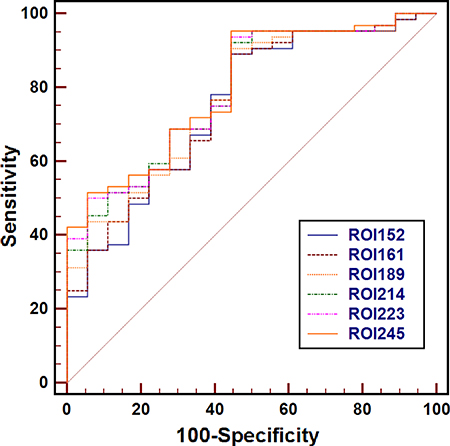 Receiver operating characteristic curves for the mean apparent diffusion coefficient measured with regions of interest (ROIs) of 152 mm2 to 245 mm2 for the differentiating between pancreatic ductal adenocarcinoma (PDAC) from normal pancreas (NP).