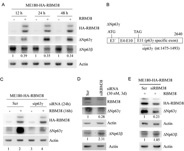 The levels of &#x394;Np63&#x3b3; and &#x394;Np63&#x3b2; proteins are differentially regulated by RBM38.