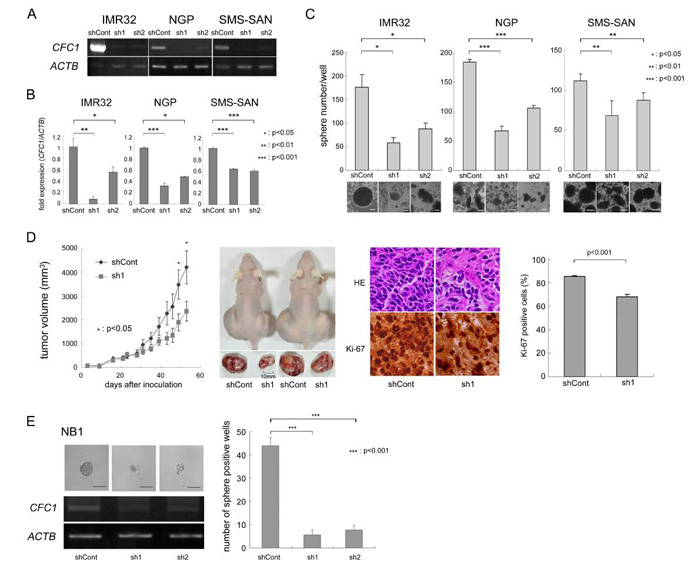CFC1 depletion suppresses tumor sphere and xenograft formation.