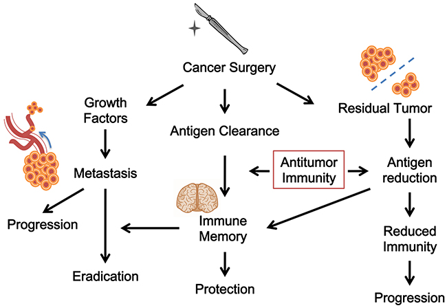 The immunological views of cancer surgery.