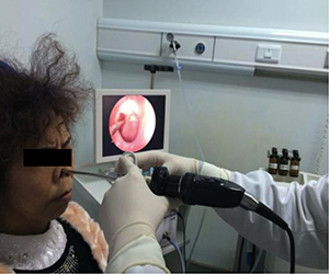 CNB was conducted under the guidance of nasal endoscope.