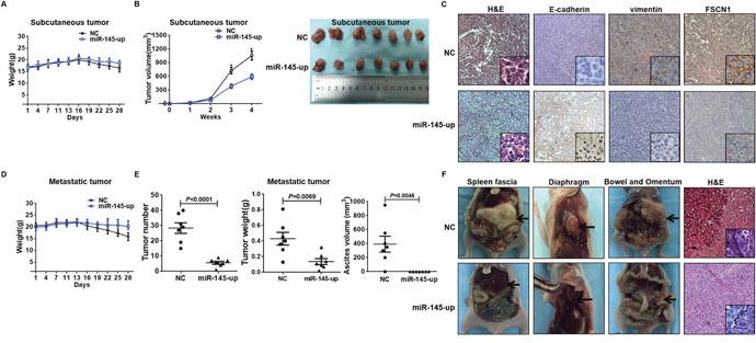 miR-145 inhibited ovarian cancer EMT in vivo.