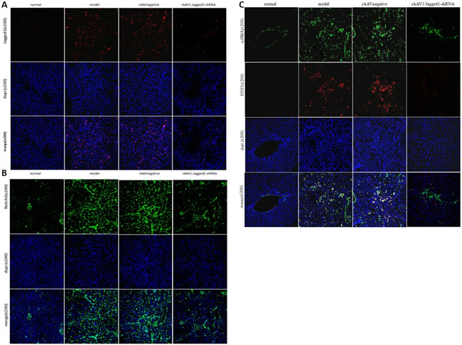 rAAV1-Jagged1-shRNA inhibited Jagged1-Notch3-HES1 in fibrotic livers in rats.