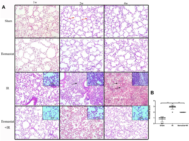 Development of the inflammation in the lung tissues after irradiation or Ilomastat pretreatment followed by irradiation.