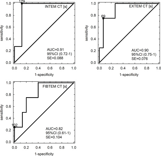 ROC curves of INTEM-CT, EXTEM-CT and FIBTEM-CT for SOS/VOD prediction.
