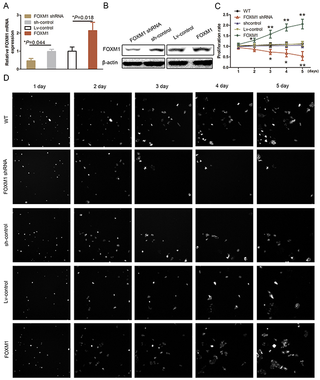 Effect of FOXM1 knockdown on regulation of HUVEC proliferation.