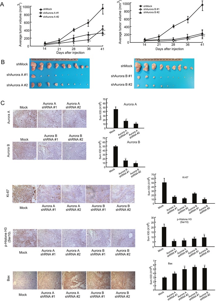 Knocking down Aurora A or B expression in KYSE450 esophageal cancer cells dramatically inhibits tumor growth in a xenograft mouse model.