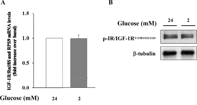Expression of IGF-1R in &#x03B1;-TC1 clone 6 cultured for 24 h in DMEM under high glucose (24 mM) and low glucose (2mM) condition.