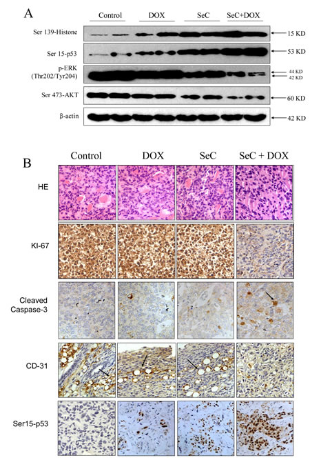 Combined treatment triggers DNA damage and inactivation of ERK and AKT in vivo.