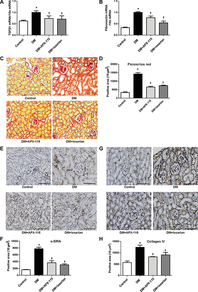 Effect of APX-115 on fibrosis in STZ-induced diabetic mice.