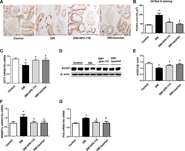 Effect of APX-115 on lipid accumulation in kidney of STZ-induced diabetic mice.