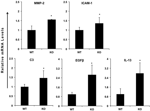 miR-149*&#x2212;/&#x2212; mouse hepatic tissue display increased expression of proinflammatory genes.