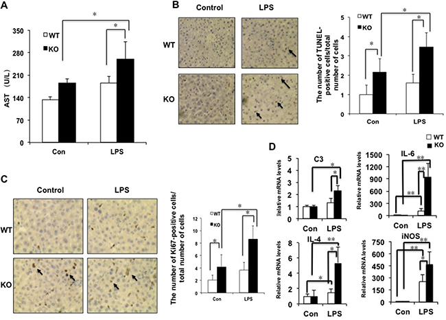 The deficiency of miR-149* in mouse liver is more sensitive to LPS-induced liver injury.