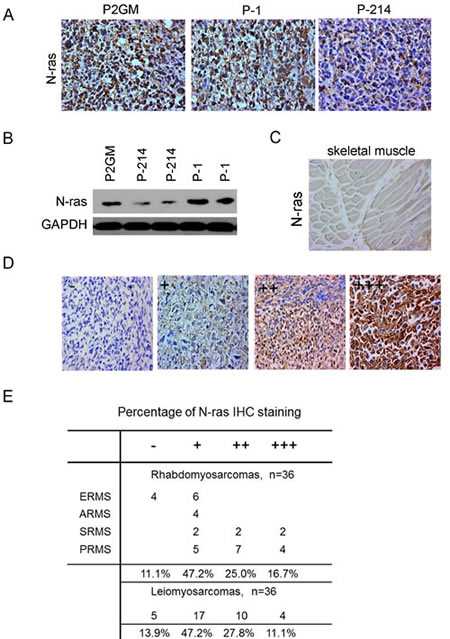 Figure 6:Up-regulation of N-ras in xenograft tumors and primary human RMS tumors.