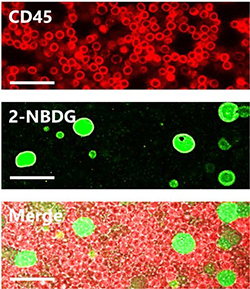 Confocal fluorescence microscopy images of 2-NBDG uptake for PBMC and MCF-7 under optimized conditions for samples containing cell ratios of 1:10 MCF-7:PBMC. Scale bars = 40 &#x03BC;m.