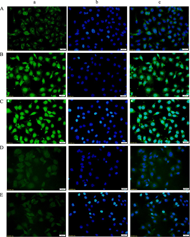 Changes in p-STAT3 expression in HUVECs from each group as assessed using immunofluorescence staining (200&#x00D7;).