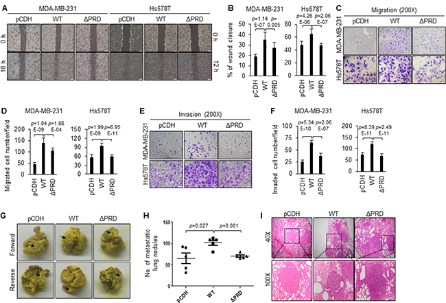 Induced expression of wild-type MORC2, but not PRD deletion mutant MORC2, enhances breast cancer cell migration, invasion and metastasis.