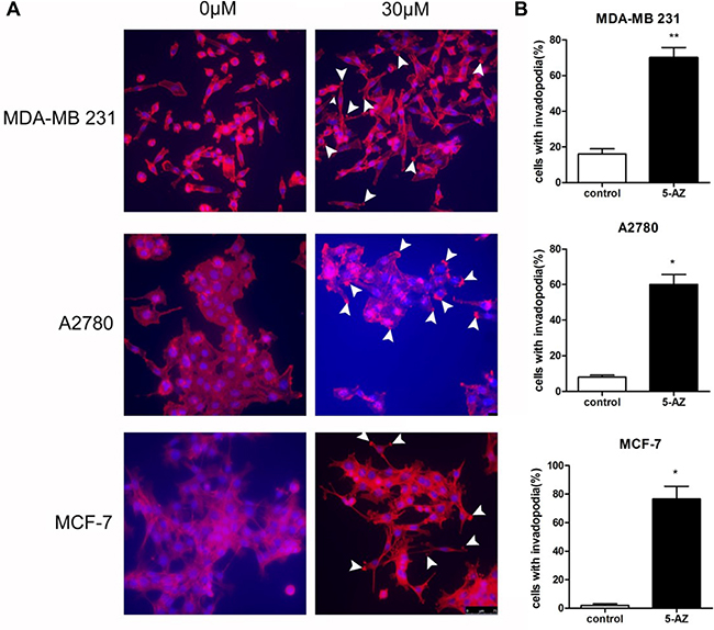 5-AZ increased the formation of invadopodia in cells of MDA-MB 231, A2780 and MCF-7.