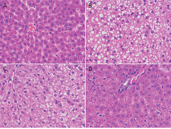 Morphological changes in mouse liver after NaAsO2 and/or EGCG.