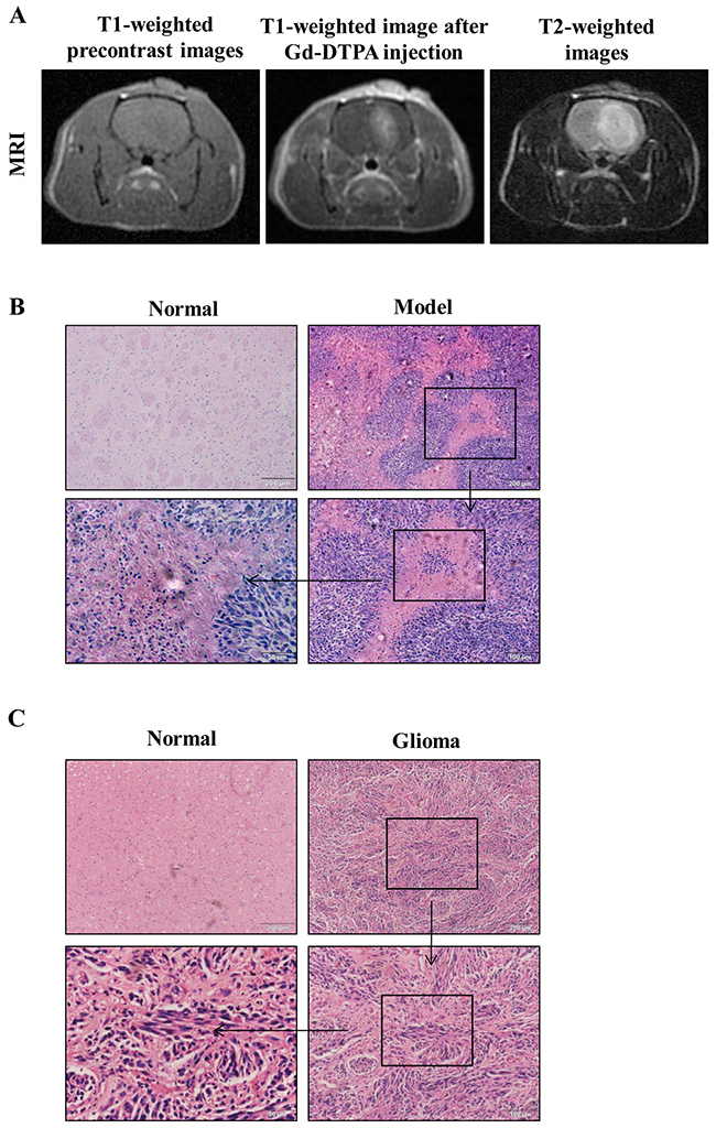 MRI and corresponding histopathological findings.