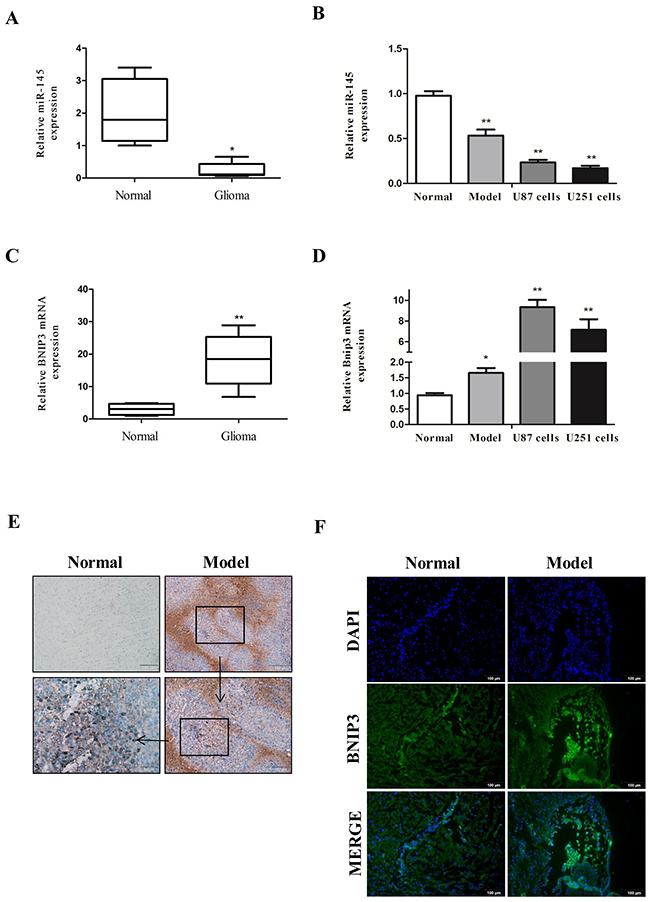 Down-regulation of miR-145 and up-regulation of BNIP3 expression in gliomas.