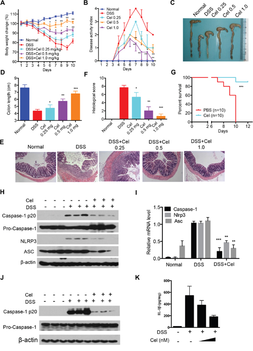 Celastrol ameliorates DSS-induced colitis in mice.