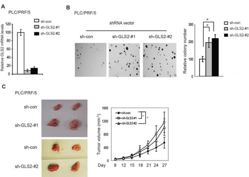 Knockdown of GLS2 promotes anchorage-independent growth of HCC cells and growth of HCC xenograft tumors.