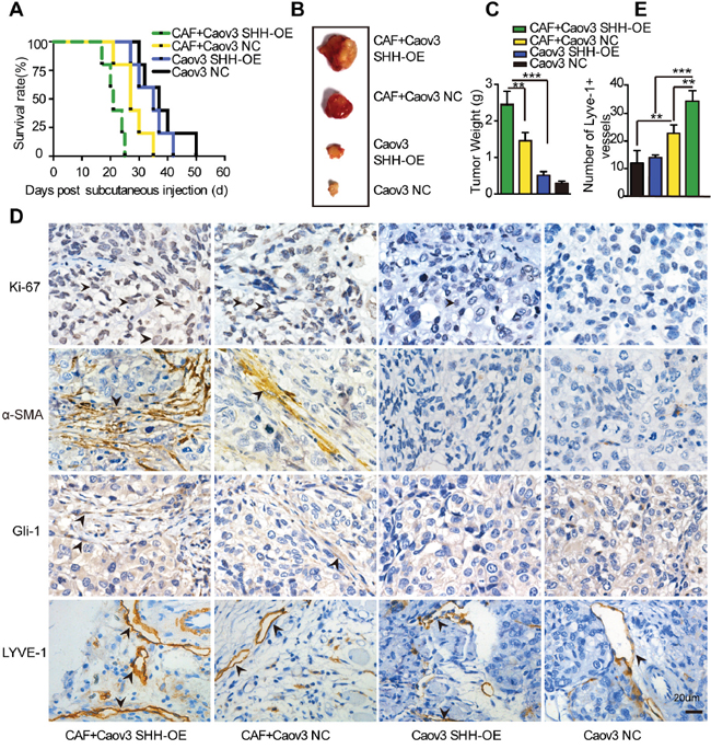 Paracrine signaling of tumour-derived SHH in CAFs promotes lymphangiogenesis in vivo.
