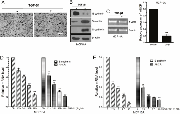 LncRNA ANCR was down-regulated in TGF-&#x03B2;1 induced EMT.