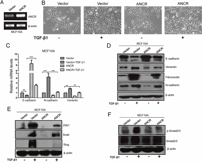 Overexpression of ANCR suppressed TGF-&#x03B2;1 induced EMT.