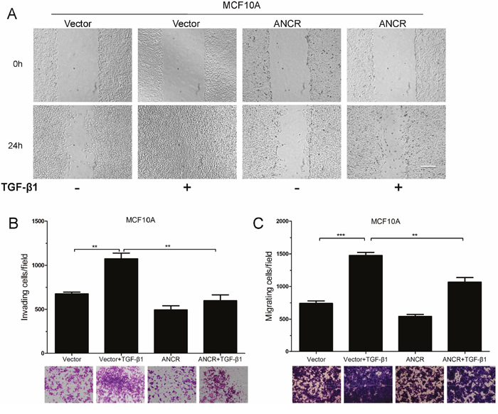 Overexpression of ANCR inhibited TGF-&#x03B2;1 induced migration.