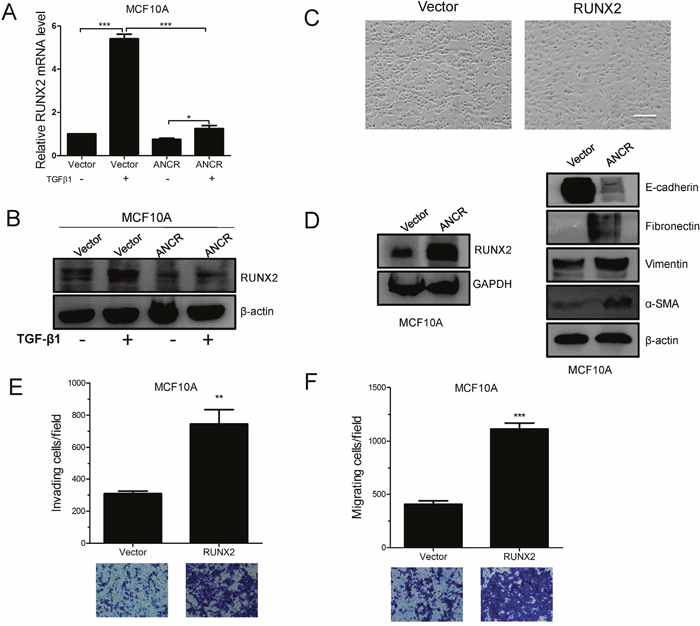 ANCR attenuated TGF-&#x03B2;1 induced EMT and migration by decreased RUNX2 expression.