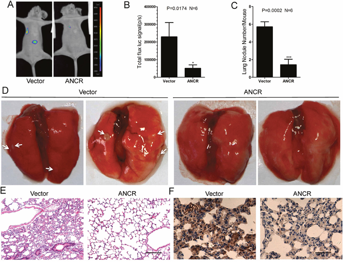 ANCR inhibited breast cancer metastasis in vivo by down regulation of RUNX2.