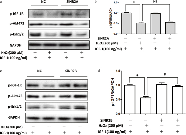 siRNA NR2B knockdown reversed the inhibitory effect of H2O2 on the pro-survival signaling of IGF-1 in SH-SY5Y cells.