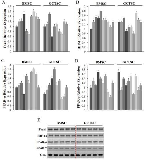 Expression profiles of Foxo1, HIF-1&#x03B1;, PPAR-&#x03B1; and PPAR-&#x03B3; in GCT.