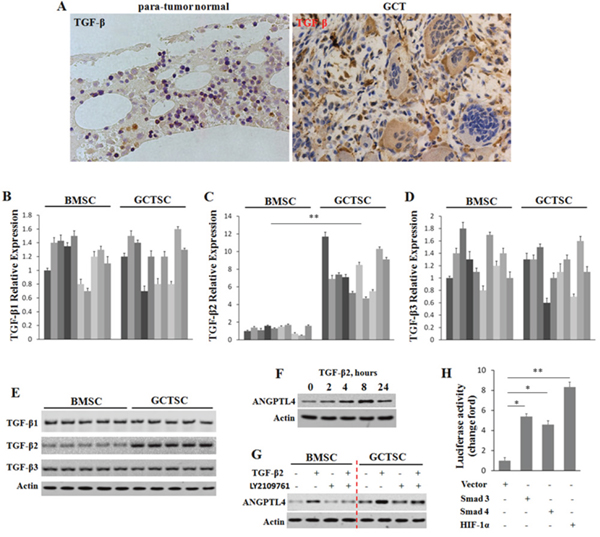ANGPTL4 enhanced by highly expressed TGF-&#x03B2;2 in GCTSCs.
