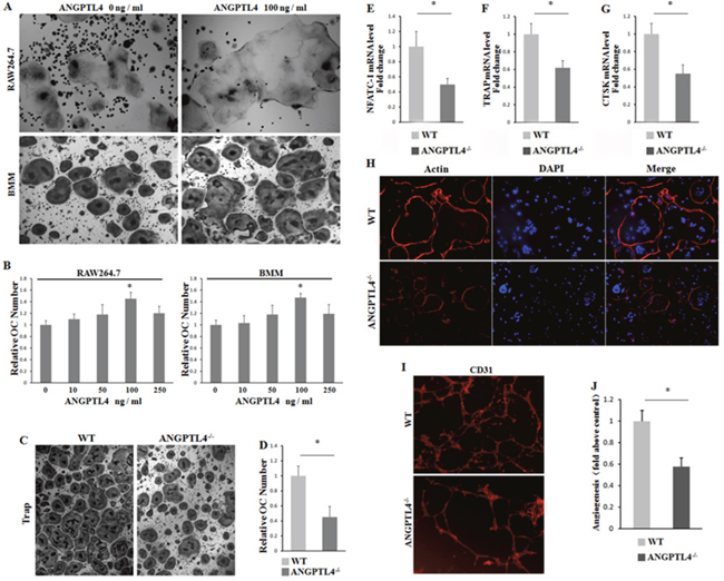 ANGPTL4 promotes GCTSC induced osteoclast proliferation and angiogenesis in vitro.