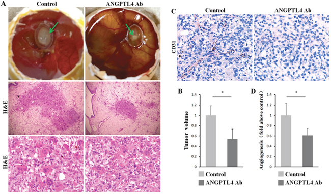 ANGPTL4 increases tumor proliferation and angiogenesis in vivo.