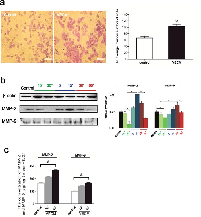 The effects of EA.hy926 conditioned medium on the invasive ability of HepG2 cells.